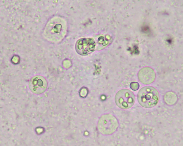 <strong>Figure 2.</strong> <i>Dientamoeba fragilis</i> trophozoites in culture. Note that D. fragilis trophozoites ingested rice starch while Blastocystis spp. not. Confirmation with microscopic examination of trichrome-stained smears are required (x400; Archive of Manisa Celal Bayar University School of Medicine Department of Medical Parasitology) 