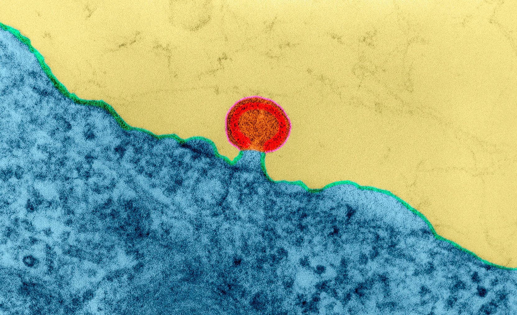 <b>Figure 1. </b>Human immunodeficiency virus budding from the cell.