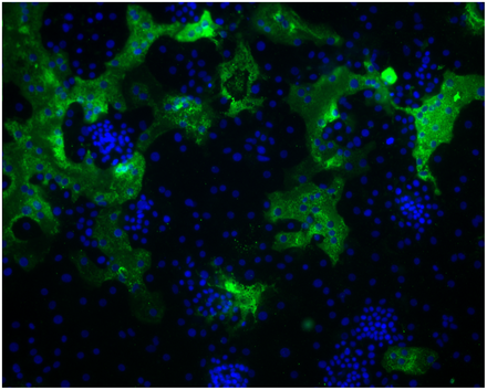 <strong>Figure 1.</strong> Formation of large syncytia of primary human alveolar type II cells infected with HCoV-HKU1 (29)