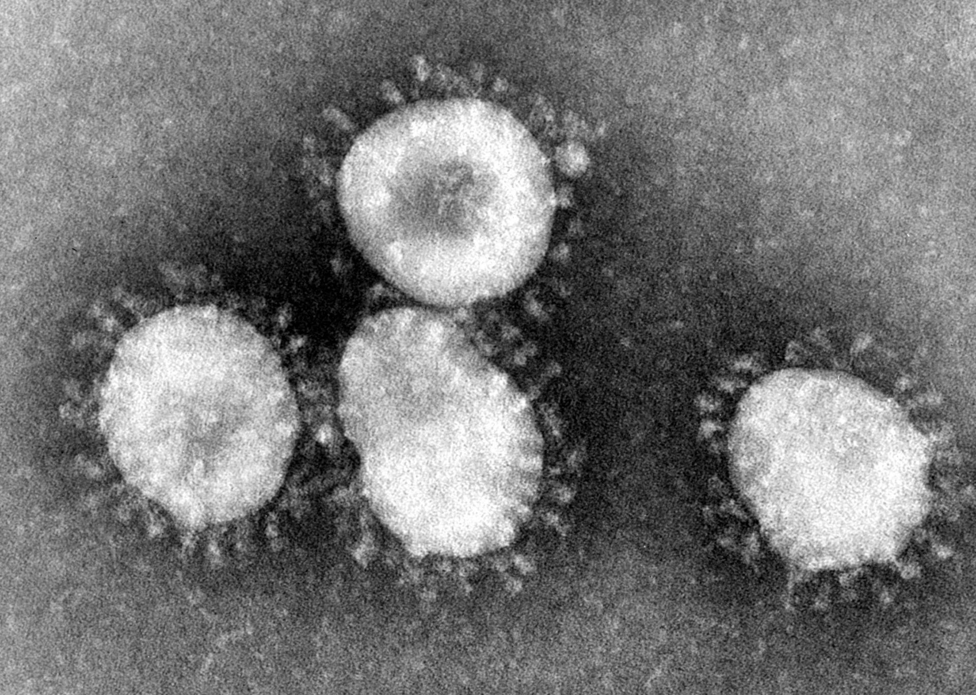 <strong>Figure 1.</strong> Electron microscopic image of Avian coronavirus. Photo Credit: CDC/Dr. Fred Murphy (1975)