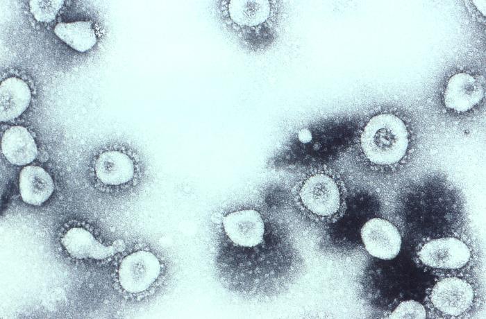 <strong>Figure 2.</strong> Electron microscopic image of human coronavirus OC43 (Betacoronavirus 1). Photo Credit: CDC/ Dr. Erskine Palmer (1981)