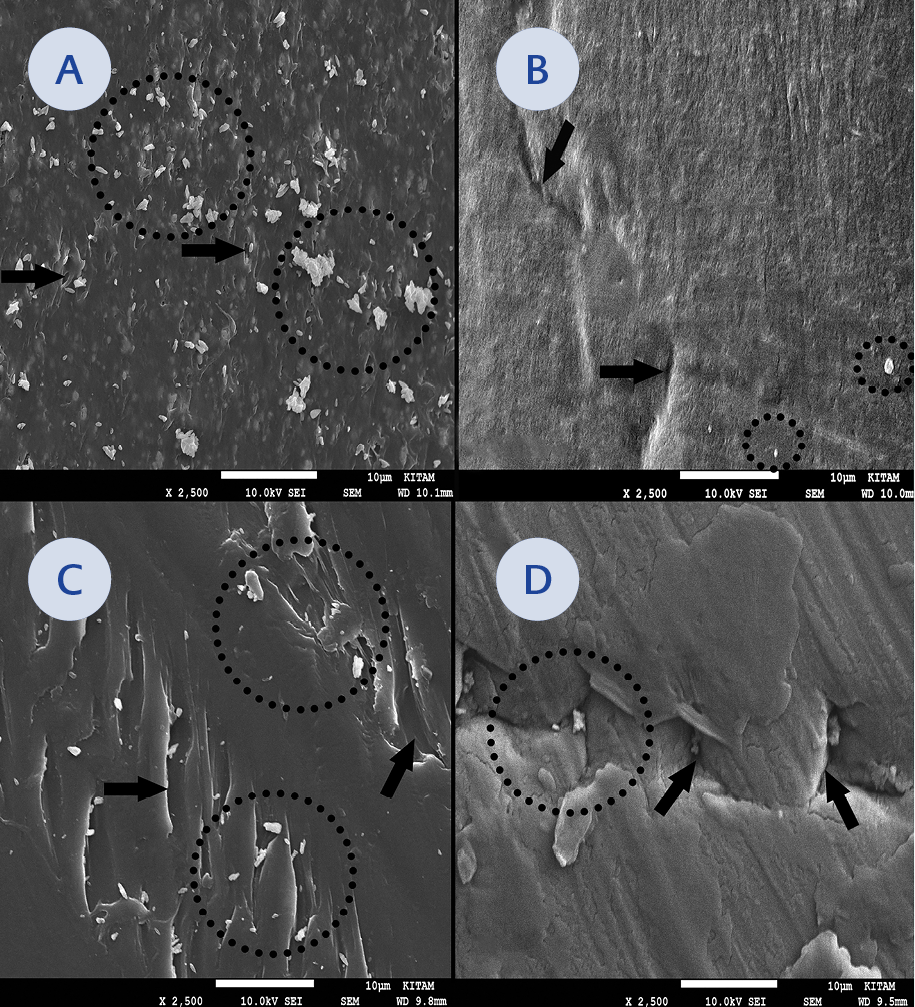 Detrimental Effects of Sterilization Types on Single-Use Coronary Angioplasty Catheters for Reuse: An Electron Microscopic Study